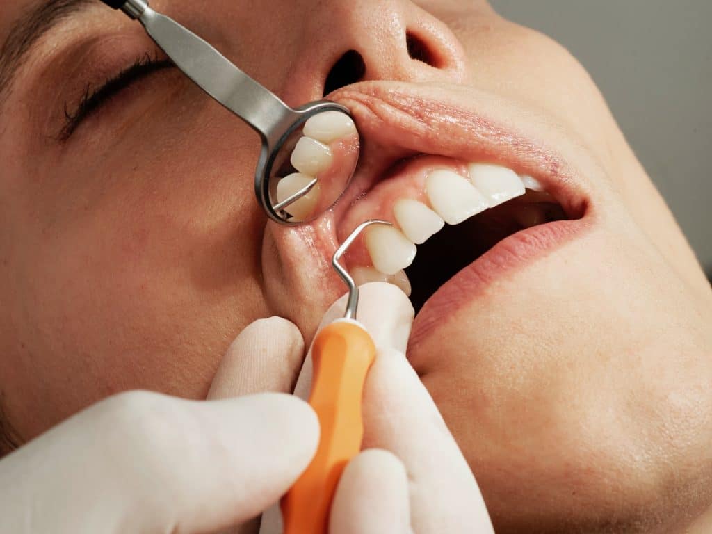 rdv contrôle dentiste